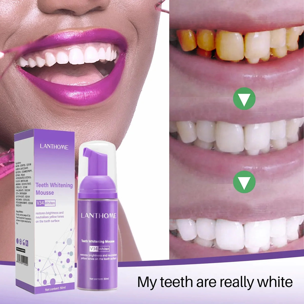 SparkSmile™ Ultimate Teeth Whitening Toothpaste (70% OFF TODAY)