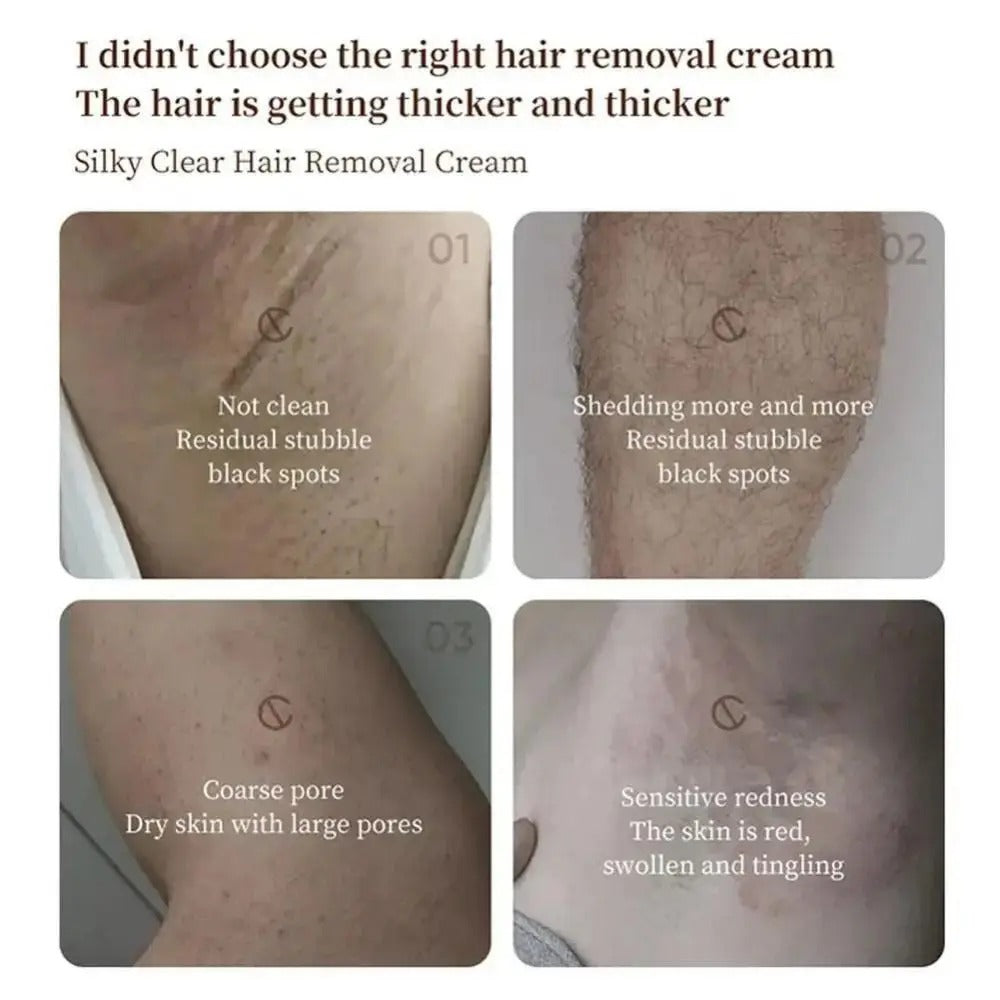 Soug® Hair Removal Cream (70% OFF Today Only)