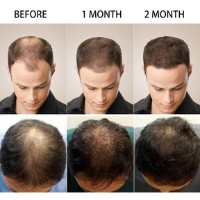 Hair Growth Oil (BUY 1 GET 1 FREE)